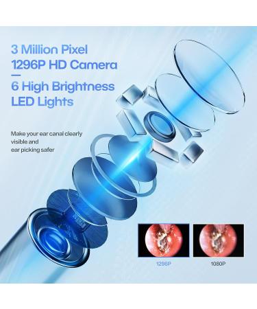 Aeasycozy Ear Wax Removal Kit with 3 Million Pixel 1296P HD Camera - Wireless Ear Cleaner with 6 LED Light & 4 Ear Sleeve Set - Buy Online on GoSupps.com