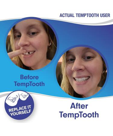 Temporary Tooth Replacement Kit - DIY Filling for Missing Tooth x2 - Buy Online on GoSupps.com