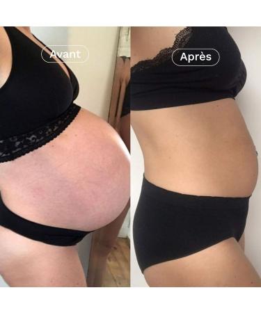 Omum - Target Stretch Marks - Duo offer 2 bottles La Surdou e - Pregnancy & Breastfeeding - Organic - 100 Milliliters - Buy Online on GoSupps.com