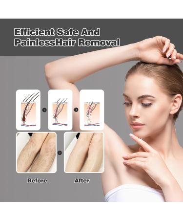 Nano Hair Remover Painless Crystal Hair Removal Device for Women & Men | Hoelg Epilator Tool - Buy Online on GoSupps.com