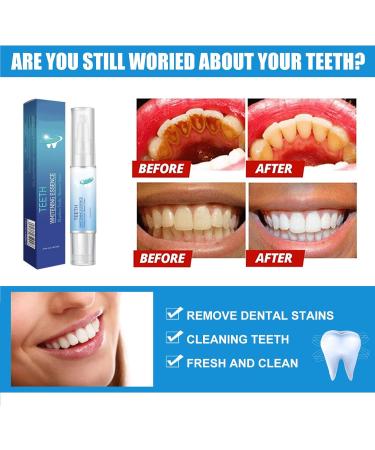 Dentizen Gum Therapy Gel & Teeth Whitening Pen Instant Results & Stain Remover (2PCs) | International Shipping - Buy Online on GoSupps.com