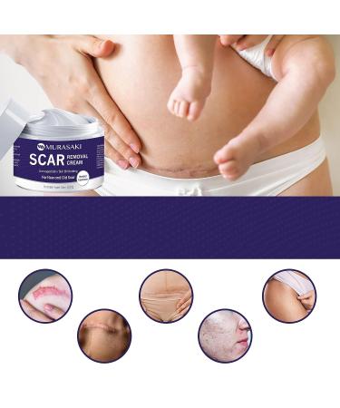MURASAKI BEAUTY Scar Cream - Stretch Mark & Scar Removal Treatment - 1 oz. / 30g - Buy Online on GoSupps.com