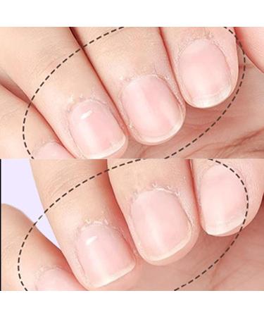 2 Pi ces Huile Cuticules Ongles Stylo Stylo Huile Revitalisant Pour Cuticules Nourrissant Le Stylos De Dissolvant De Cuticuless Fissur es Pour La Manucur Soin Des Bords De La Peau Des Ongles - Buy Online on GoSupps.com
