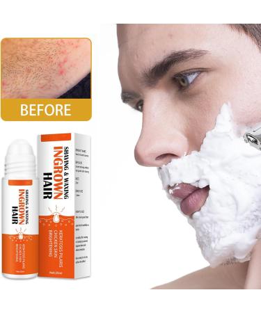 Fashion Base Ingrown Hair Treatment Roll-On - Reduce Razor Bumps and Ingrown Hairs - Soothing Serum for Ingrow Solutions - After Shave Ingrown Hair Reduction - Buy Online on GoSupps.com