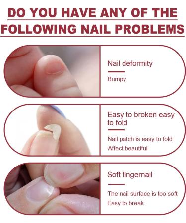 5g Nail Repair Gel for Cracked and Broken Nails - Instant Nail Treatment Kit - Buy Online on GoSupps.com