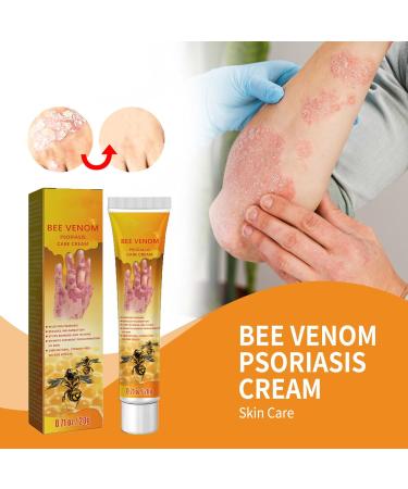 Hhkuize Bee Venom Psoriasis Treatment Cream - Natural Eczema Moisturizing Cream (6PCS) - Buy Online on GoSupps.com