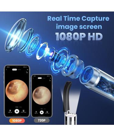 Ear Wax Removal Otoscope with Camera and Light - 1080P Waterproof Digital Ear Scope for iOS & Android - Ear Cleaner Tool Kit with Ear Pick - Buy Online on GoSupps.com