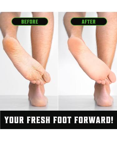 Viking Revolution Tea Tree Body Wash for Men - 12 Fl Oz - Helps with Athlete's Foot, Jock Itch, Eczema & Body Odors - Extra Strength Tea Tree Oil Formula - Buy Online on GoSupps.com