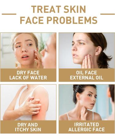 Rice Toner 150ML Smoothing Pore Minimizer & Moisturising Facial Toner - Niacinamide Essence for Dry Skin - Redness & Exfoliating - 1pc - Buy Online on GoSupps.com
