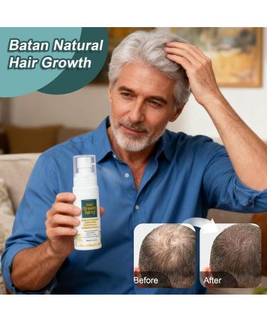  szaluyk hair growth spray scalp regrowth treatment moisturizing care conditioner conditioner oil to support follicles daily scalp refresh for a scalp - Buy Online on GoSupps.com