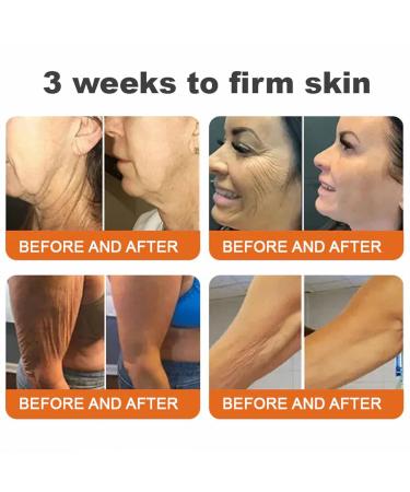 Miqicos Bee Venom Firming Serum Stick Advanced Firming & Wrinkle-Reducing Cream Restore Skin Elasticity Moisturizing Lifts Plumps and Firms Skin Works for all skin (2) - Buy Online on GoSupps.com