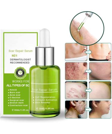 Goopgen Advanced Scar Repair Serum - Medical Grade Treatment for All Types of Scars - Moisturizing and Skin Smoothing Formula - 1 Pc - Buy Online on GoSupps.com