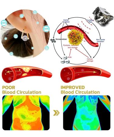 Flyolux Halolux Lymphatic Drainage Earrings - Germanium Magnetic Therapy Earrings in Silver & Gold - Buy Online on GoSupps.com