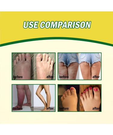 Antihump Lymphcare Ginger Ointment Antihump Ginger Ointment Ginger Legs Anti Swelling Cream Ginger Anti Cellulite Ointment Anti Cellulite Ointment Ginger Soothing Cream Anti Cellulite Leg Ointment 2PC - Buy Online on GoSupps.com