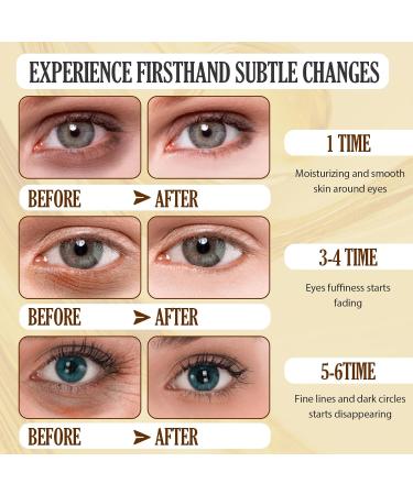 60 Patchs Masque Yeux 24K Or lutter contre les poches et les rides Hydratant Soulager la Fatigue Soin claircissant Contour des Yeux pour Femmes/Hommes WZTYMO2K - Buy Online on GoSupps.com