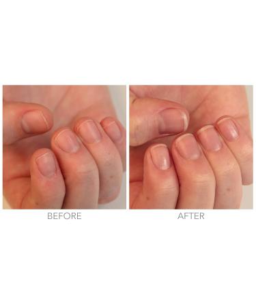 LONDONTOWN kur Restorative Nail Cream 1 Fl Oz - Nail Strengthener and Repair Treatment - Buy Online on GoSupps.com