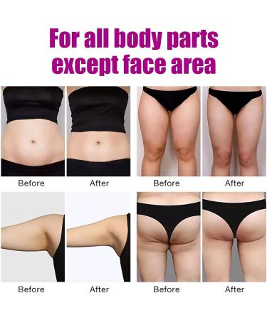 Losing Weight Patches - Rapid Slimming & Detox Plaster for Fat Burning - 5 Pieces | Appetite Suppression - Buy Online on GoSupps.com