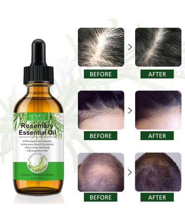ZODENIS Rosemary Oil for Hair Growth (2 60ML) Organic Essential Oil 100% Pure Natural Deeply Nourishing Scalp Stimulates Growth Thickening Hair Rid of Dry 100 ml - Buy Online on GoSupps.com