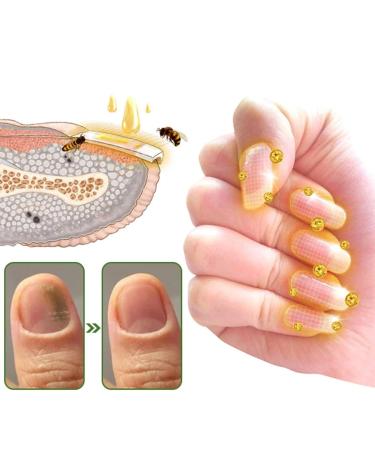 Furzero Nail Defense Bee Venom Serum: Nail Growth & Repair Treatment for Stronger Healthier Nails - Buy Online on GoSupps.com