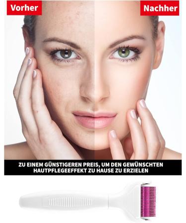 Zitfri 8-in-1 Derma Roller - Microneedling Tool for Body & Facial Care | Anti-Wrinkle Acne & Pregnancy Scar Treatment | Violet Jade Roller - Buy Online on GoSupps.com