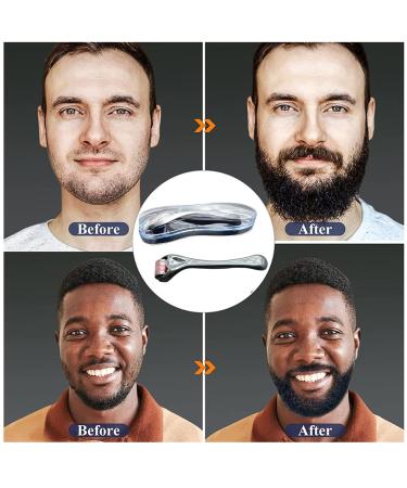 IOPYKKOA Beard Roller 0.5mm for Beard Growth | Microneedling Derma Roller | Enhance Facial Hair Growth | International Shipping Available - Buy Online on GoSupps.com