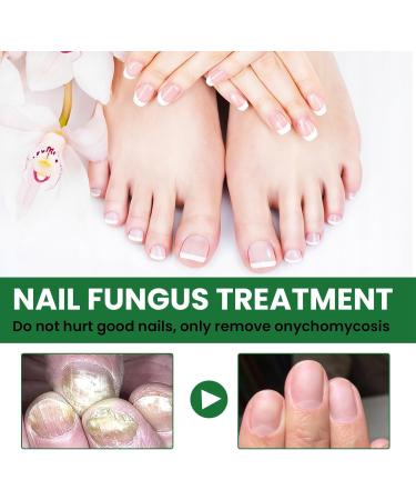 MrCuvaryas Nail Serum for Toenails Extra Strong - Buy Online on GoSupps.com