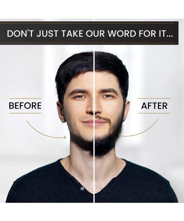 Beard Growth Kit for Men - Titanium Microneedle Roller, Natural Oil, Balm, Wooden Comb, Complete Grooming Set for Hair Growth - Travel-Friendly Gift - Buy Online on GoSupps.com