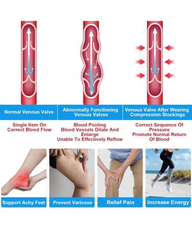 Ted Hose Compression Stockings - Anti-Embolism Thigh High Socks for Men & Women - 15-20 mmHg Compression - Beige with Inspect Toe Hole - Buy Online on GoSupps.com