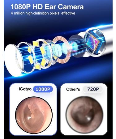 1080P FHD Ear Wax Removal Tool Camera with 6 LED Lights - Waterproof Endoscope for iPhone & Android - Ideal for Adult, Kids, and Pets - Black - Buy Online on GoSupps.com