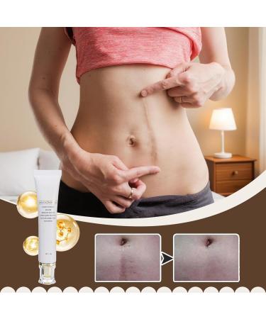 Gen rico Scar cream 30g natural moisturizing skincare products - Stretch mark cream for morning day night face body travel home - Buy Online on GoSupps.com