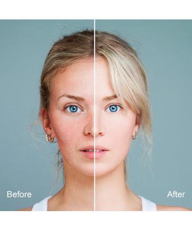 TRIXES Facial Hair Remover - Spring Epilator for Quick & Effective Hair Removal - Buy Online on GoSupps.com
