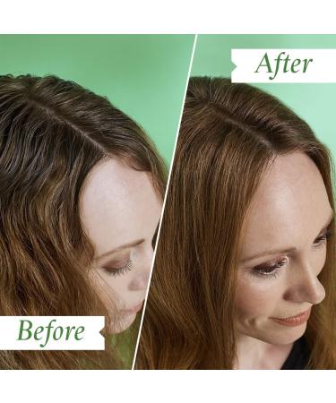 PHILIP KINGSLEY Flaky Scalp Shampoo - Cleansing Scalp Care for Dry, Oily Scalps - Soothes and Calms - 8.45 Fl Oz - Buy Online on GoSupps.com