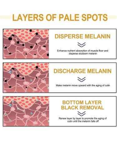 KOAHDE Whitening Freckle Cream Facial Spot Removing Cream Moisturizing Anti-Blemish Cream Spot Lightening Cream for Face Dark Spots Remover Skin Whitening Cream Brightening Whitening Tone up Cream - Buy Online on GoSupps.com