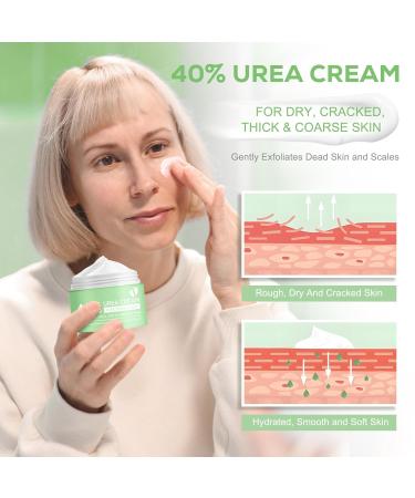 40% Urea Cream with 2% Salicylic Acid - Intensive Foot Cream for Dry Cracked Skin - Aloe Vera & Tea Tree - Exfoliates Dead Skin - 4.2 oz - Buy Online on GoSupps.com