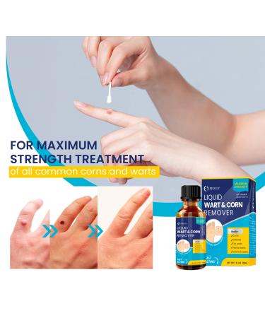 Meoly Maximum Treatment Liquid Corn & Callus Remover for Fast Foot Care - Plantar & Common Callus Treatment for Kids & Adults - Buy Online on GoSupps.com