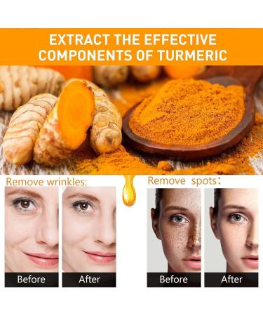 Turmeric Face Serum - Dark Spot Correcting Glow Serum with Turmeric Oil for Skin - Reduces Age Spots - Moisturzing Body & Face Oils and Serums. - Buy Online on GoSupps.com