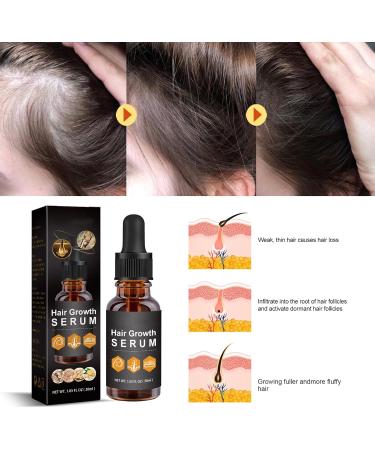Hair Growth Serum Ginger Hair Growth Oil for Bald Thin Hair Repairs Hair Follicles Stronger Hair Hair Growth Oil for Women & Men - Buy Online on GoSupps.com