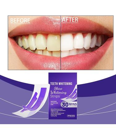 Bande Blanchiment Dentaire Violet Bandes Violette Blanchissant Dentaire Teeth Whitening Strips Violet limine Taches Caf /Th /Vin 30 Minutes De R sultats Visibles Rapidement Dents Blanches (2) - Buy Online on GoSupps.com