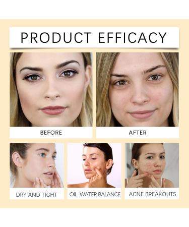 Cleansing Oil - Dissolvant de maquillage pour les yeux - limine le maquillage des yeux et des l vres - Pour maquillage imperm able - Huile de nettoyage pour tous les types de peau - Doux et apaisant - Buy Online on GoSupps.com