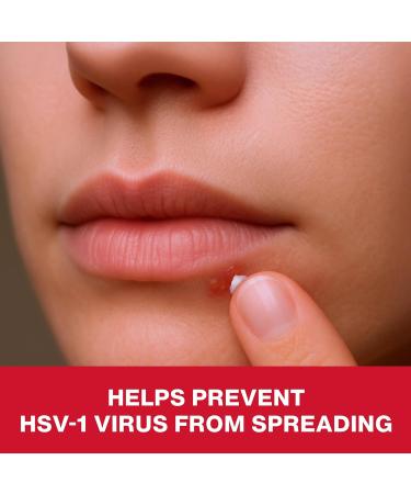 Blistex Cold Sore Treatment Docosanol Cream 10% Starts Working Immediately Medicine to Reduce Healing Time of Cold Sores/Fever Blisters - 1 Count 2.0g/0.07oz - Buy Online on GoSupps.com