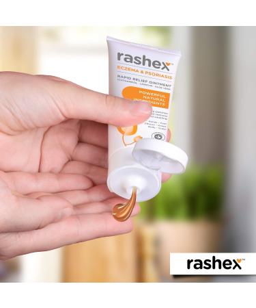 Rashex Eczema & Psoriasis Treatment Ointment | Black Ichthammol 20% | Fast Relief | 2 Oz Tube - Buy Online on GoSupps.com