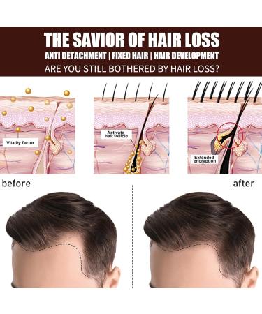 Rosemary Oil for Hair Hair Growth Oil Ginseng Hair Regrowth Serum Relieve Dry Damaged Hair to Target Hair Loss Hair Growth Oil for Hair Rapid Growth and Thickening Trengthen Hair Roots - Buy Online on GoSupps.com