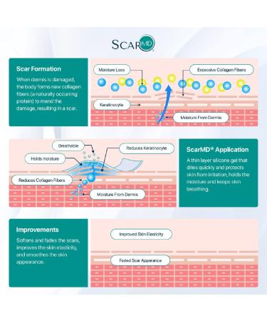 ScarMD Medical Grade Silicone Scar Treatment Gel (15g) for Surgical Scars, C-Section, Cuts, Burns - 0.52oz - Buy Online on GoSupps.com