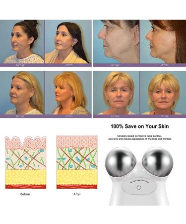 2023 New Microcurrent Face Roller - Lift and Tighten Skin | USB Mini Facial Rejuvenation Device in Pink - Buy Online on GoSupps.com