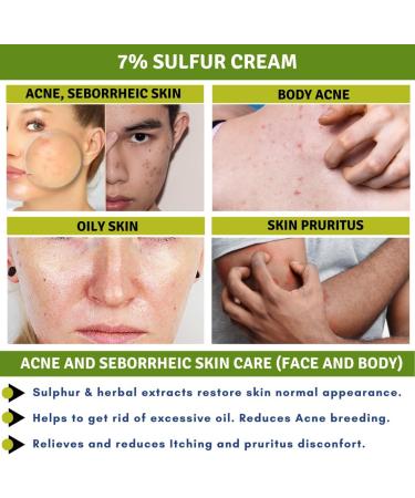 TIS Pharmaceutical TIS Sulfur 7 Cream For Oily Acne Seborrheic Skin Care Removes Skin Seborrheic Flakes Exfoliating Properties Face and Body Unisex - Buy Online on GoSupps.com