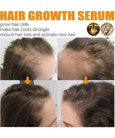 Ibealee Biotin Hair Growth Mist Ibealee Hair Growth Essential Oil Biotin Herbal Essence Ginger Hair Growth Essence - Buy Online on GoSupps.com
