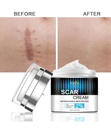 Scar Removal Cream - Repair & Moisturize Old/New Scars, for Male/Female, Surgery/Scald/Burns - 1.85 FL OZ - Buy Online on GoSupps.com
