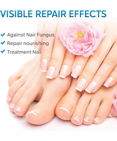 Fungal Nail Treatment Cream - Strong Anti-Fungal Toenail Repair and Restoration - Buy Online on GoSupps.com