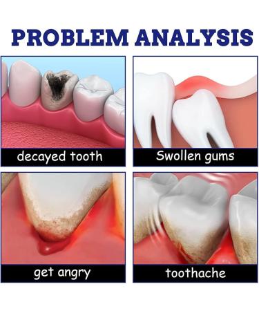 Instant Teeth Treatment Relief Spray | Toothache & Muscle Pain | 3-PC Remedies for Healthy Gums & Repair Gingival Tissue - Buy Online on GoSupps.com