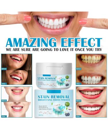Blueberry Baking Powder for Tooth Care | Refreshing Mouth Solution for Yellow Teeth Smokers & Coffee Drinkers - Buy Online on GoSupps.com